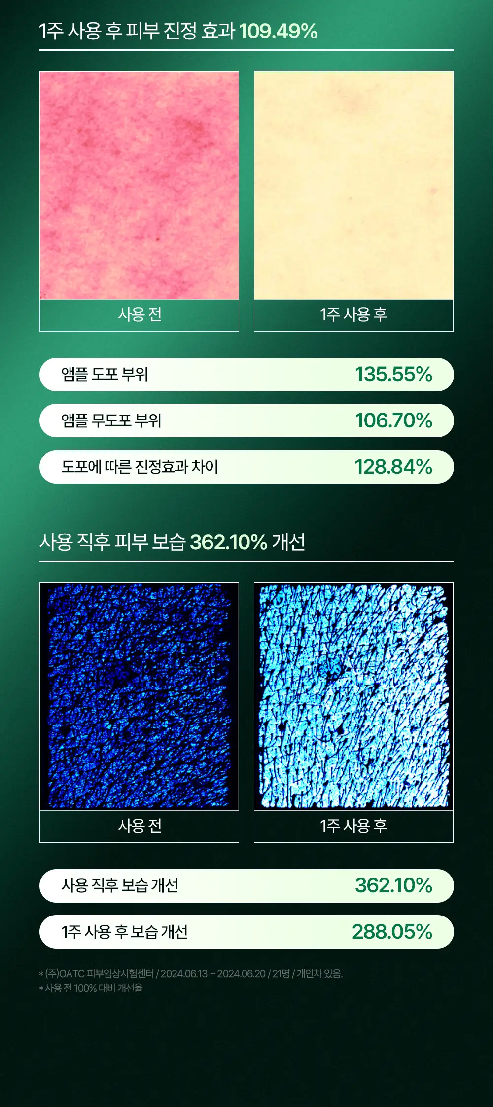 [티벳동생 공동개발] 오아조 피디알엔 쓰리디 부스팅 앰플 30ml 상세페이지 5